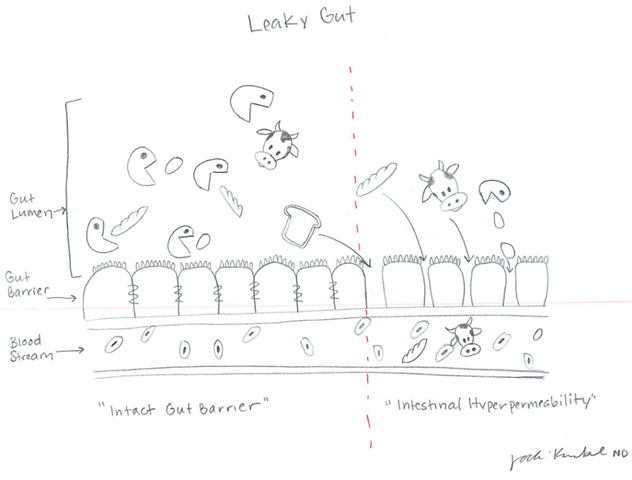 leaky gut jodi.png