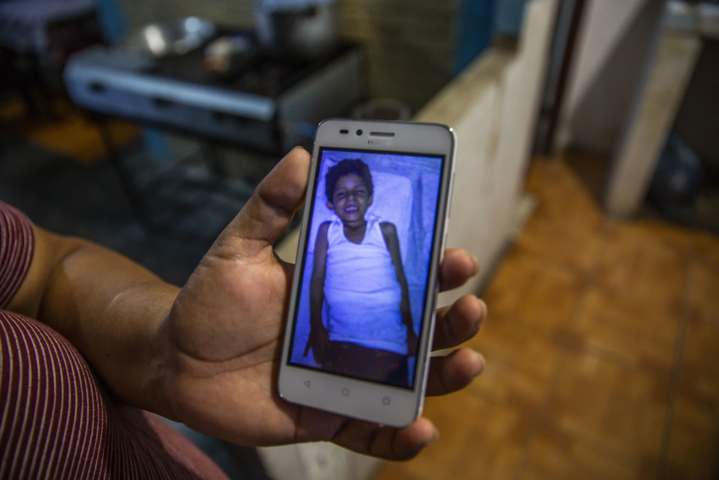 Jose Danilo Ramos is 10 and was born with anorectal malformation. He was first operated at four years old at the public hospital, but it was a disaster. He came out infected with pneumonia and his stomach was so inflamed that he couldn’t eat and was almost starving to death.