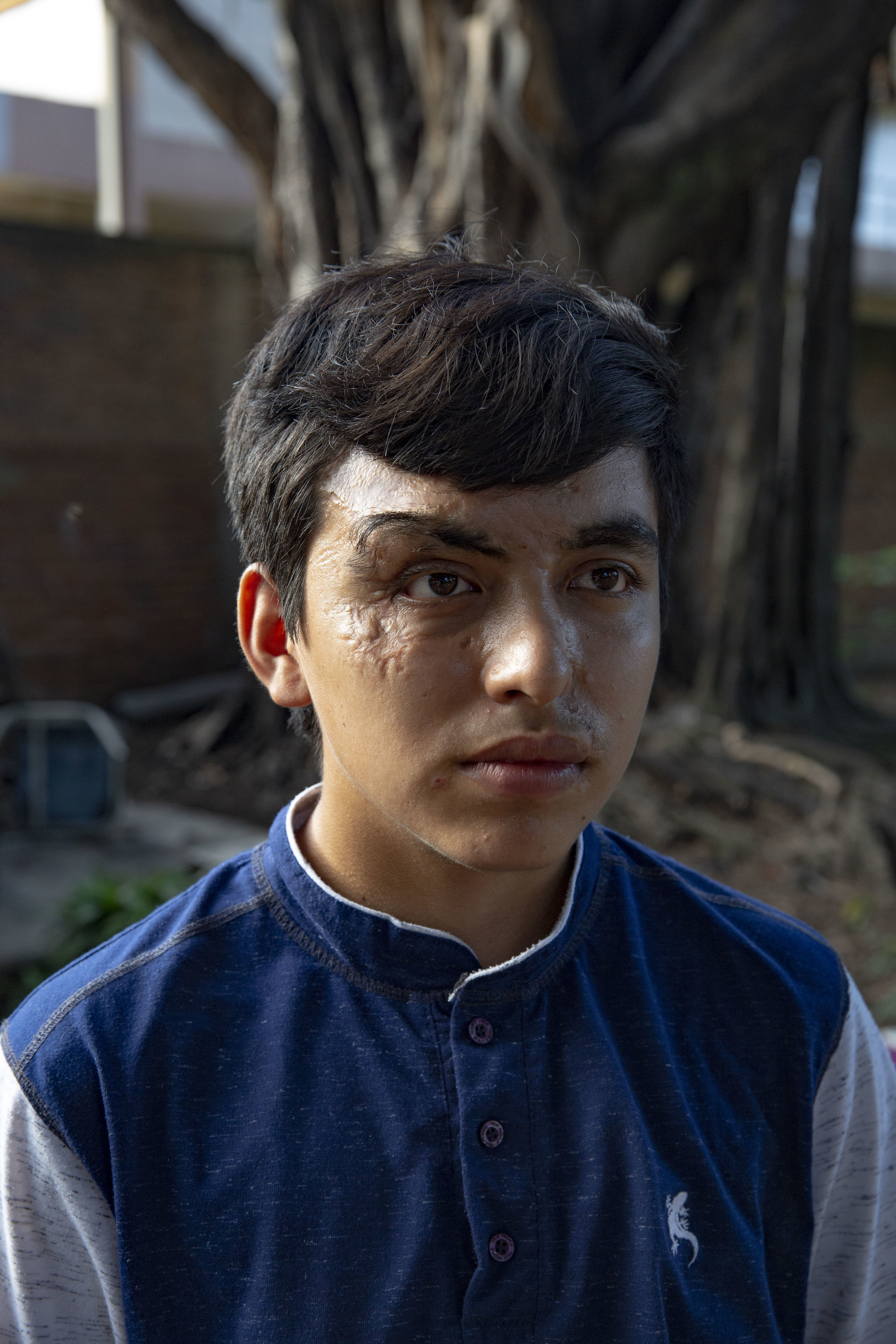 Christian Velasquez, he had several surgical operations after an car accident in 2012. Here in the courtyard of his house in San Pedro Sula, Honduras. He recevied extensive help from the Ruth Paz fundation.