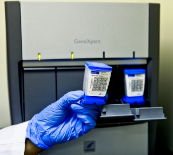 TB diagnostic tools. Photo by Dr. Madhu Pai.
