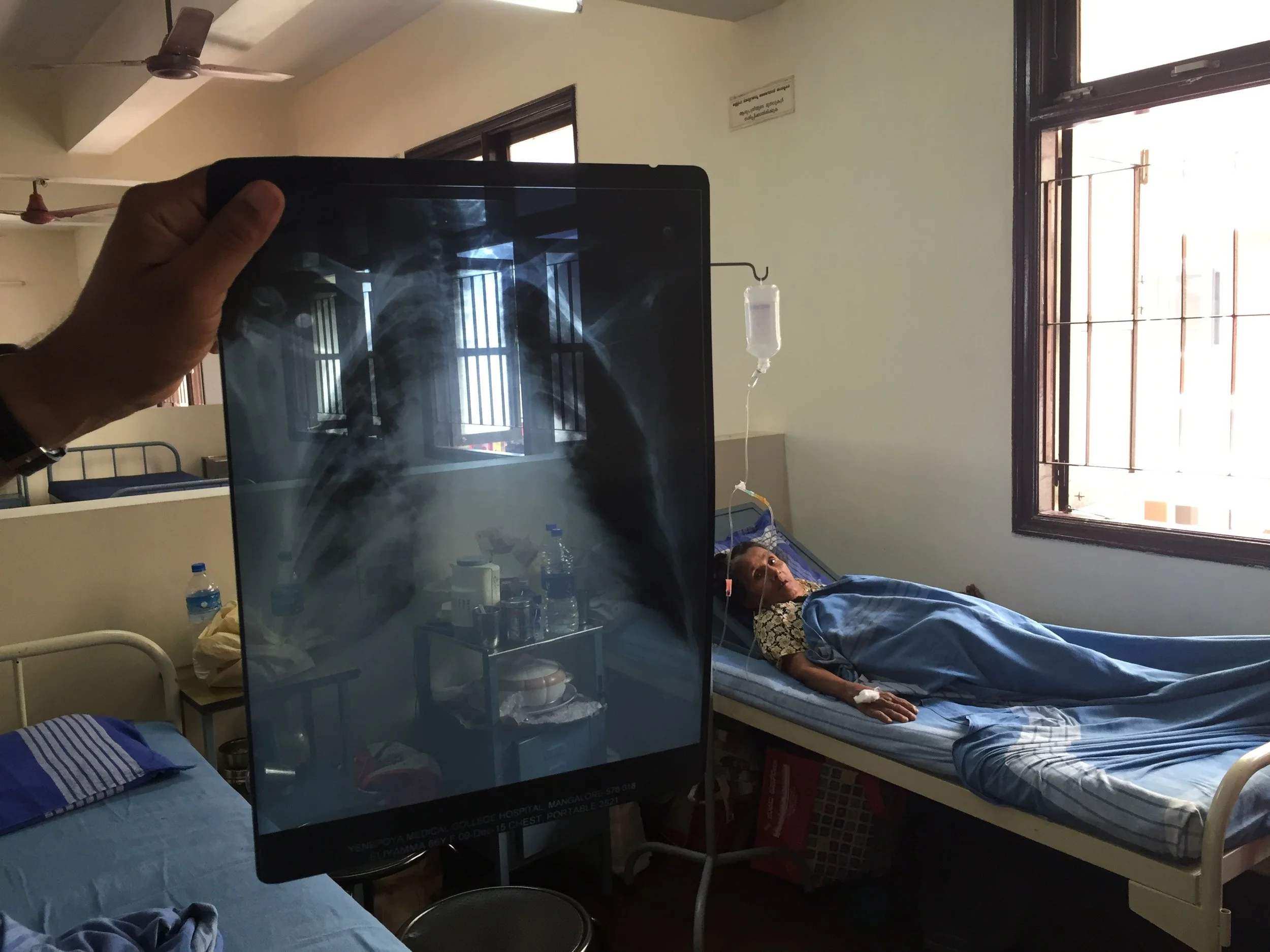 New Numbers On Tuberculosis Burden Must Galvanize India To Act