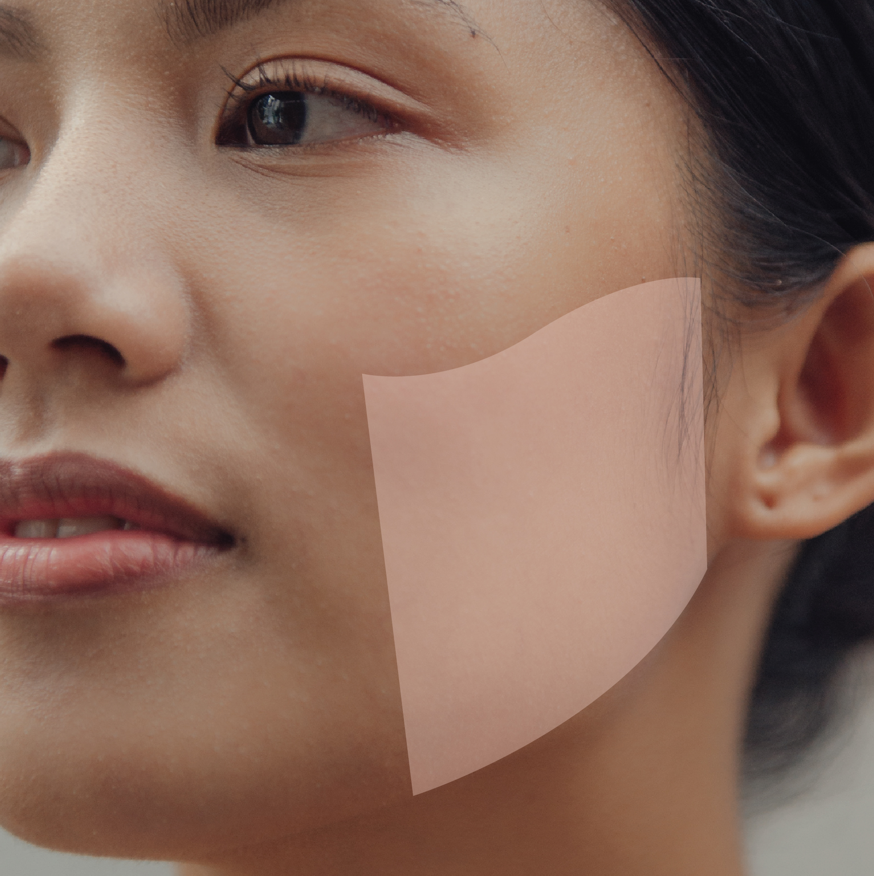 Ulthera-_Cheeklift.jpg
