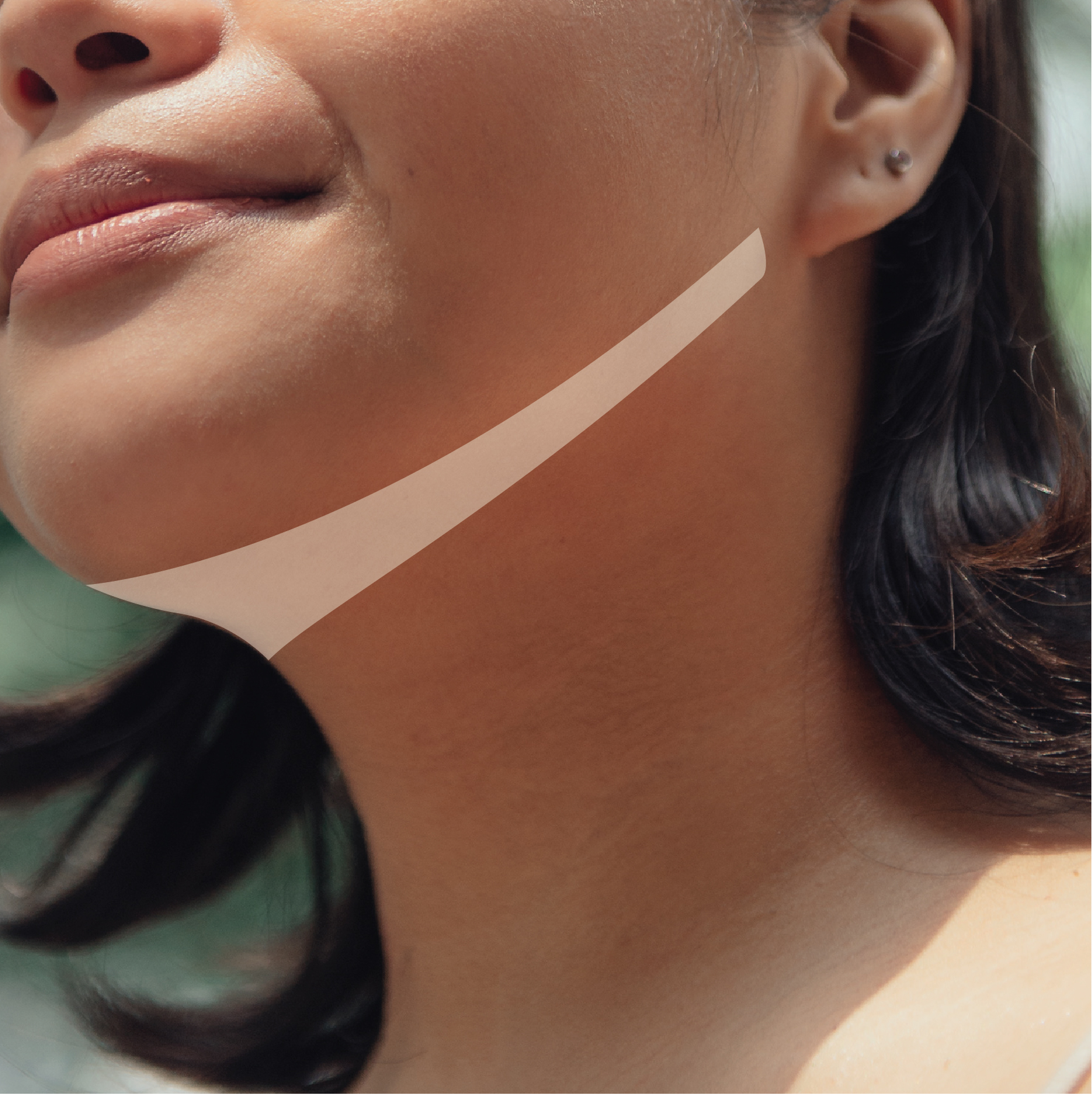 Ulthera-_Under the chin lift.jpg