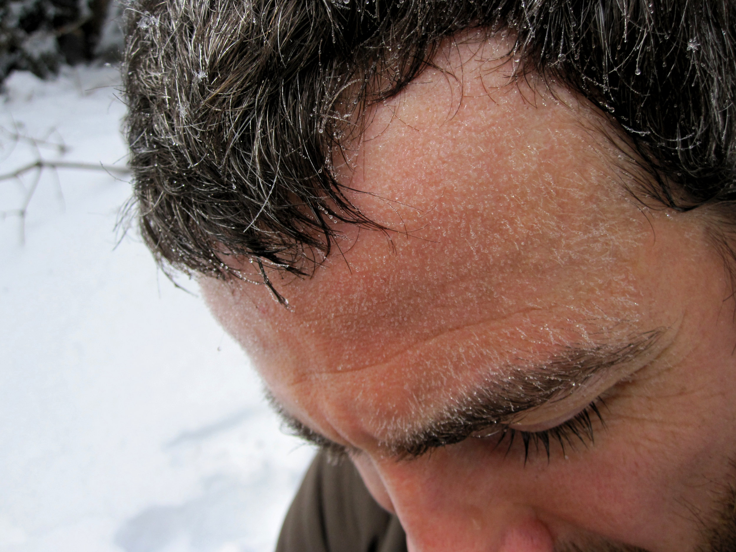 Dale’s sweat on his “forehead fuzz” is freezing!
