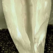 Clean Root after the GentleWave Procedure *