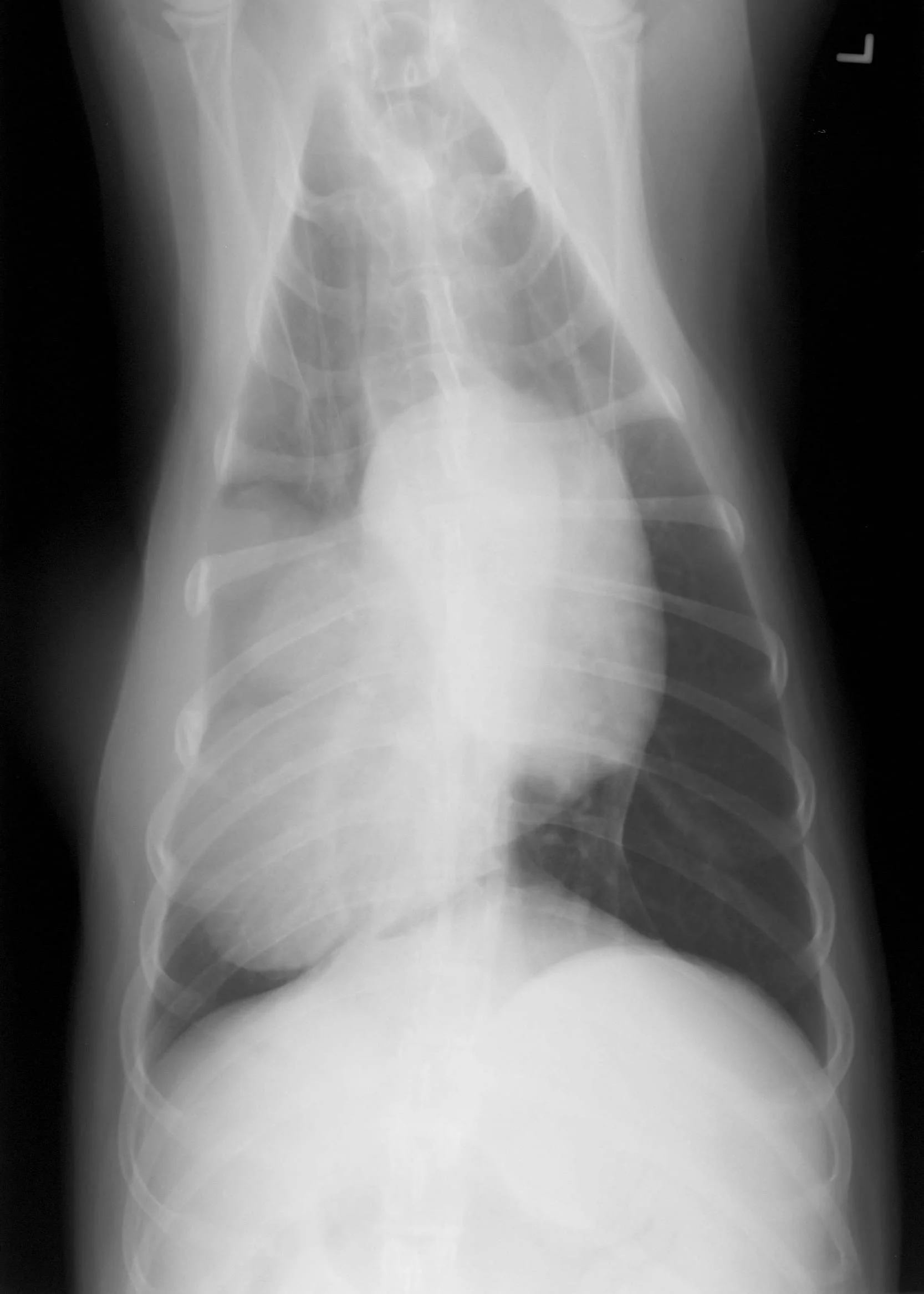 Bone Cancer In Ribs Survival _ Bone Cancer Survival Rate Chart – YQSSGW