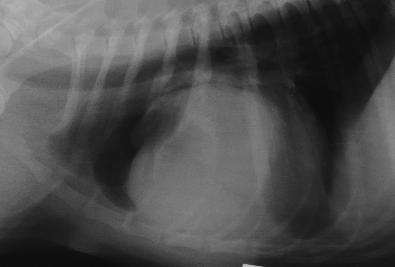 Bone Tumors Rib — DR. JULIUS LIPTAK