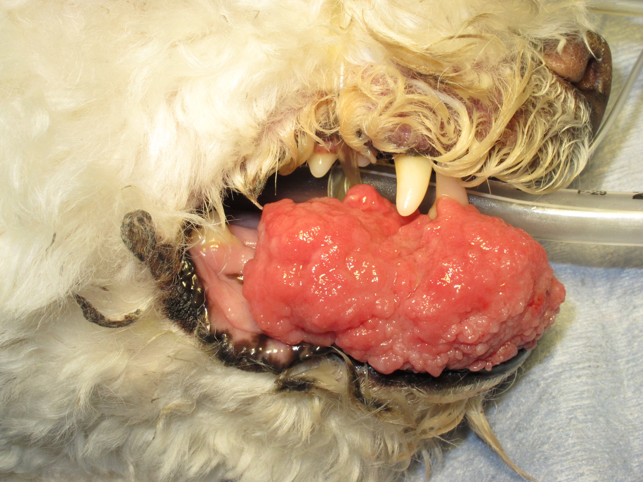 Acanthomatous Ameloblastoma
