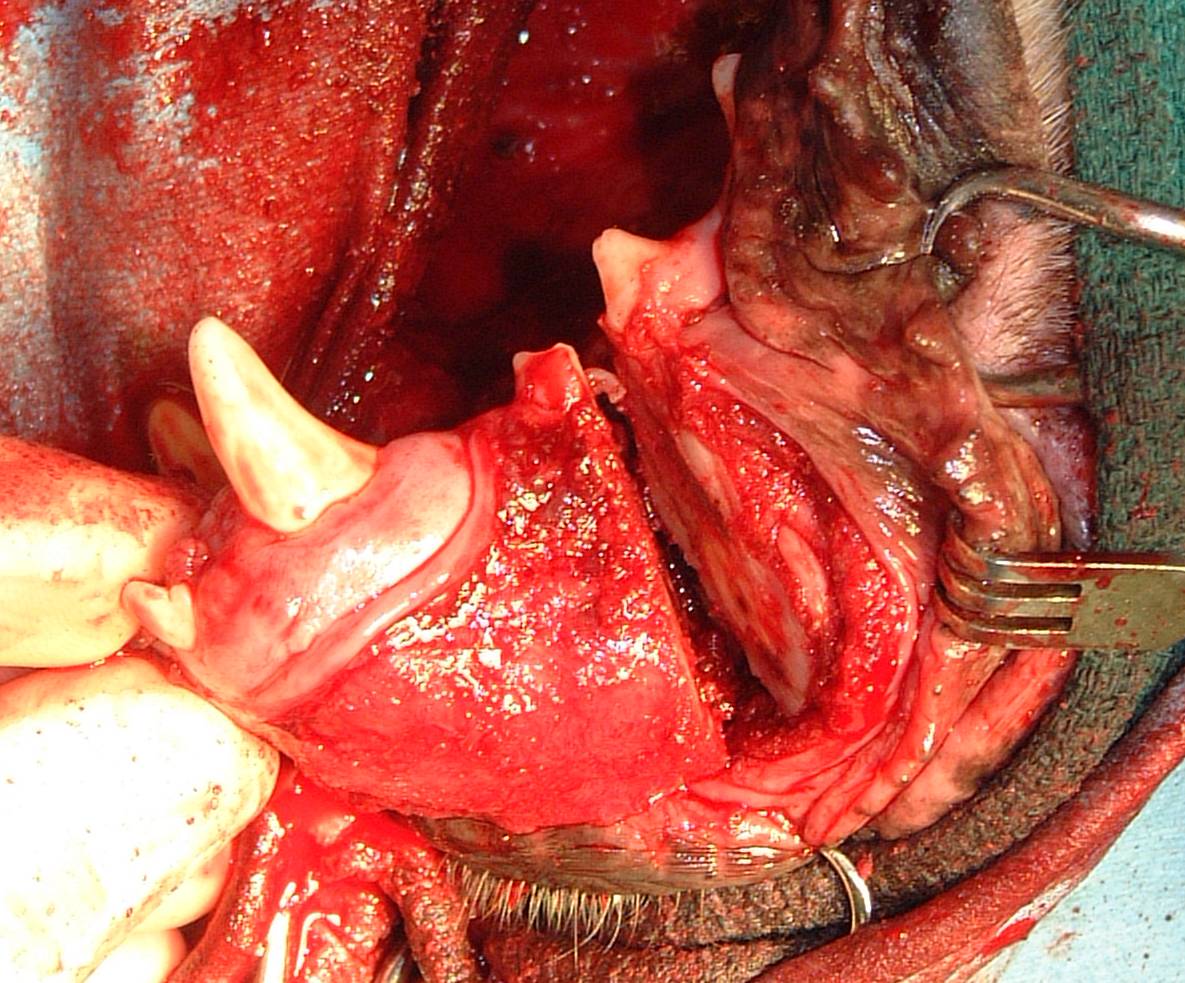 UNILATERAL ROSTRAL MANDIBULECTOMY