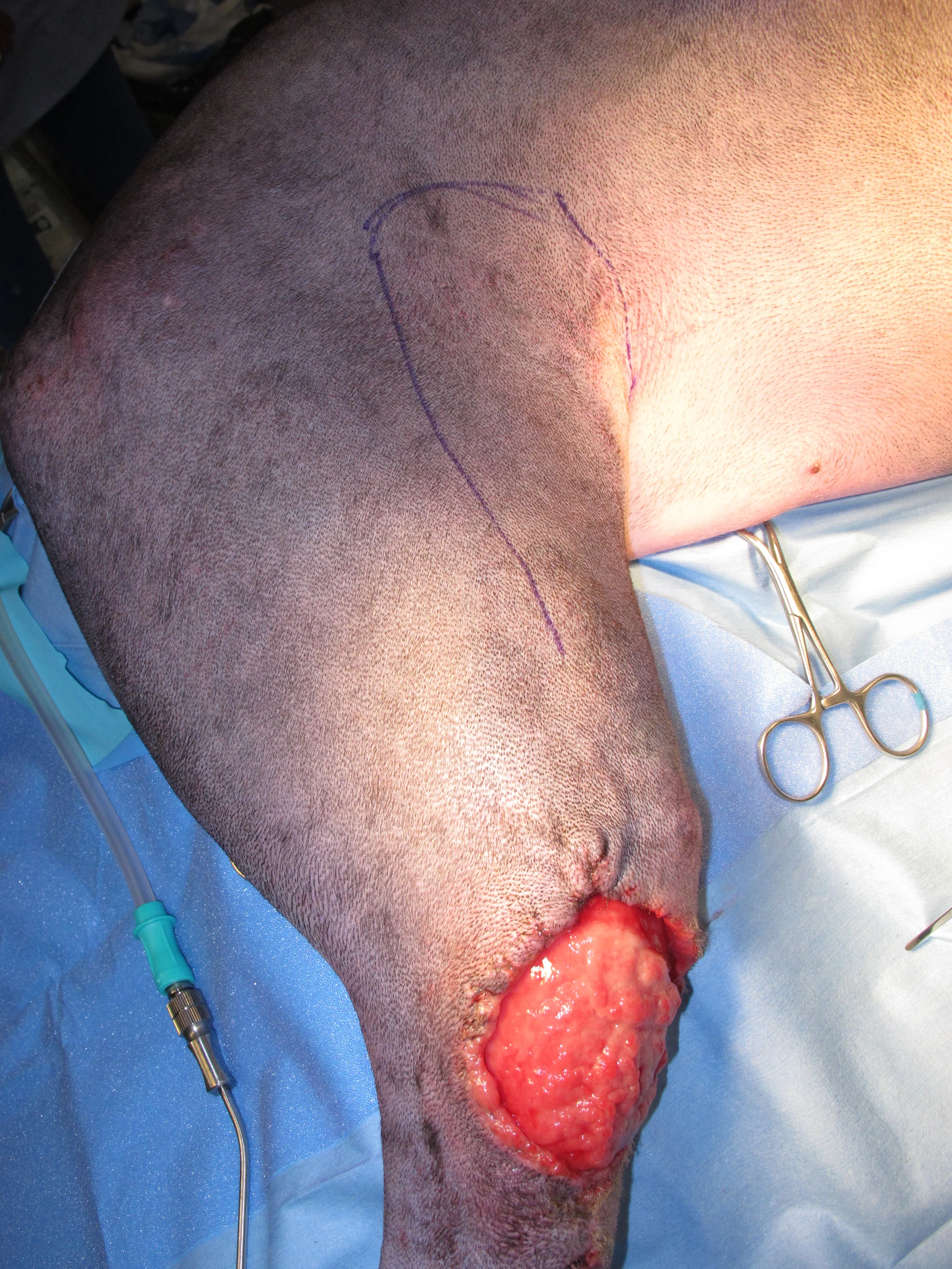 Preoperative