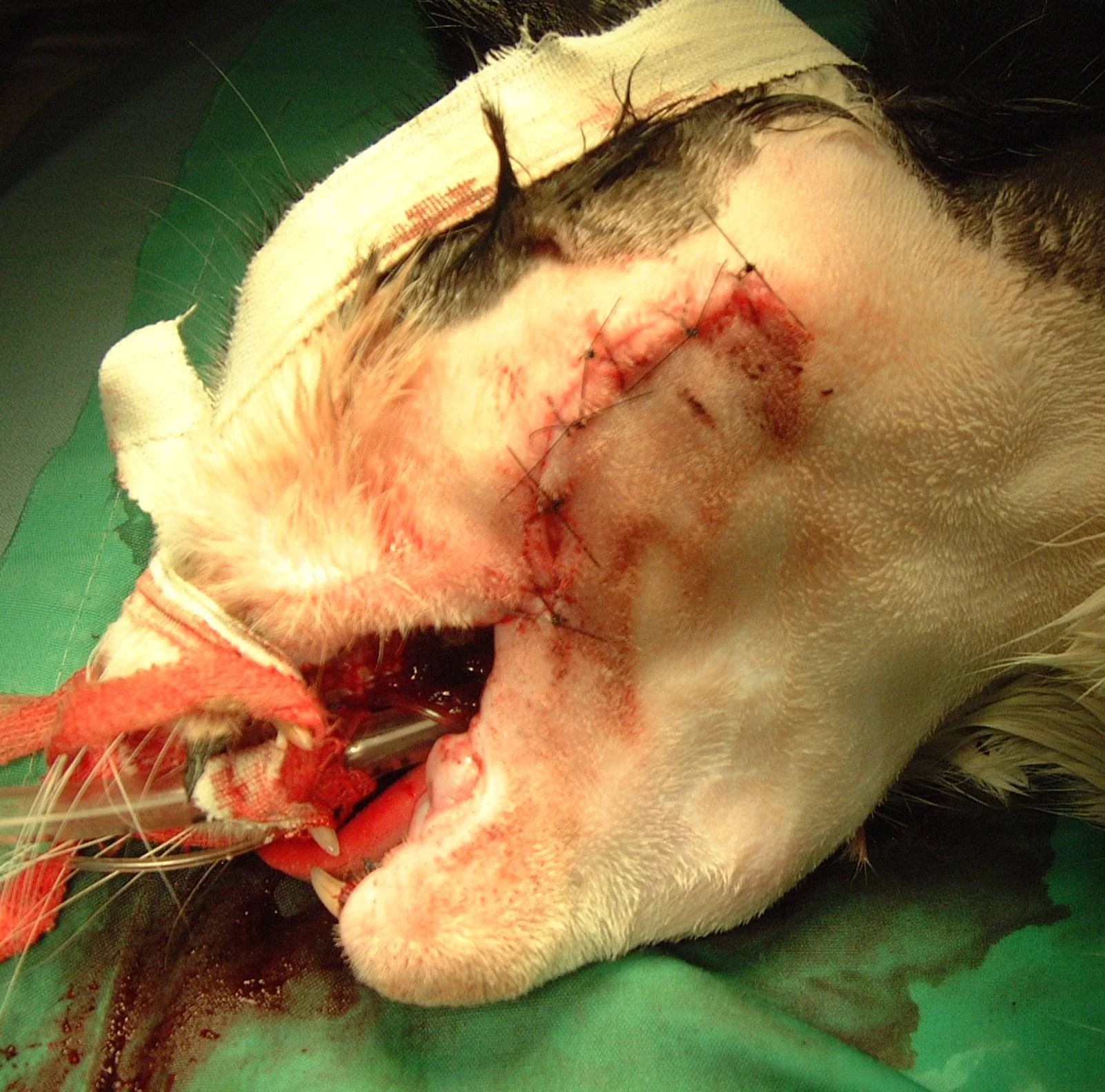 Immediate Postoperative