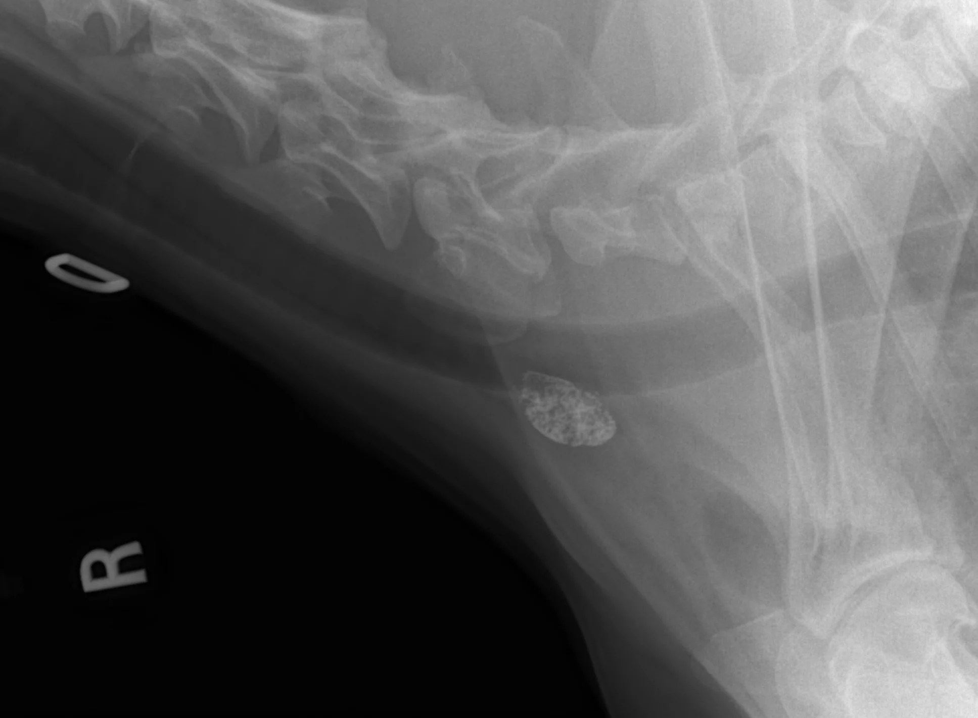 A lateral regional radiograph (prior to surgery and 24 hours after Lipidiol injection) in a dog with a digit squamous cell carcinoma showing the sentinel lymph node is the prescapular lymph node.