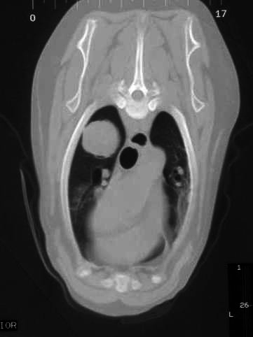 CT Scan - Lung Metastasis (OSA)