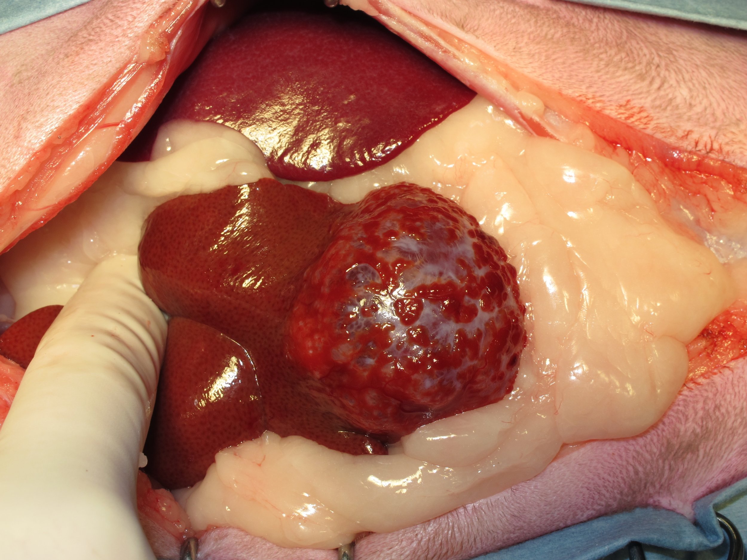 Abdominal Tumors - Liver — DR. JULIUS LIPTAK