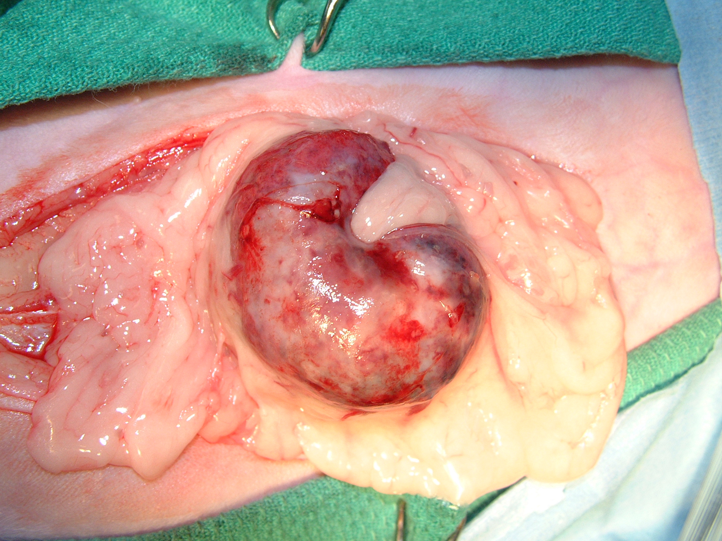 Abdominal Tumors Spleen — DR. JULIUS LIPTAK