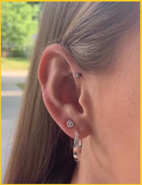 Forward Helix - Double Lobe