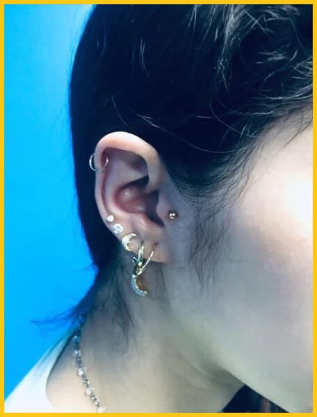 Tragus-Lobes-Helix