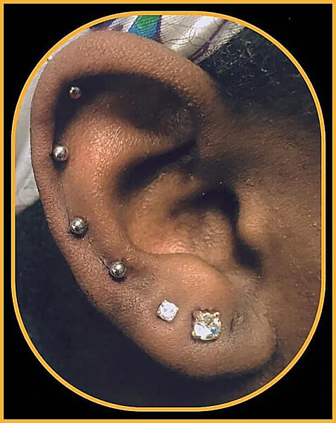 Lobes-Cartalidge