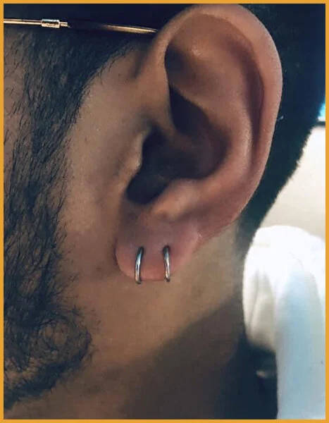 Double Lobes