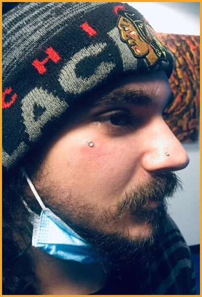 Dermal