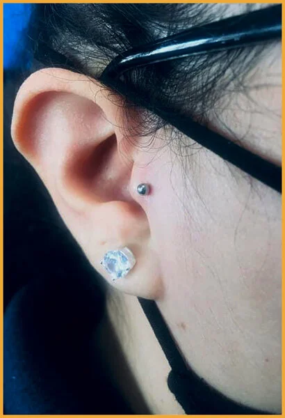 Tragus-Lobes