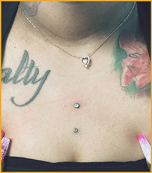 Dermals