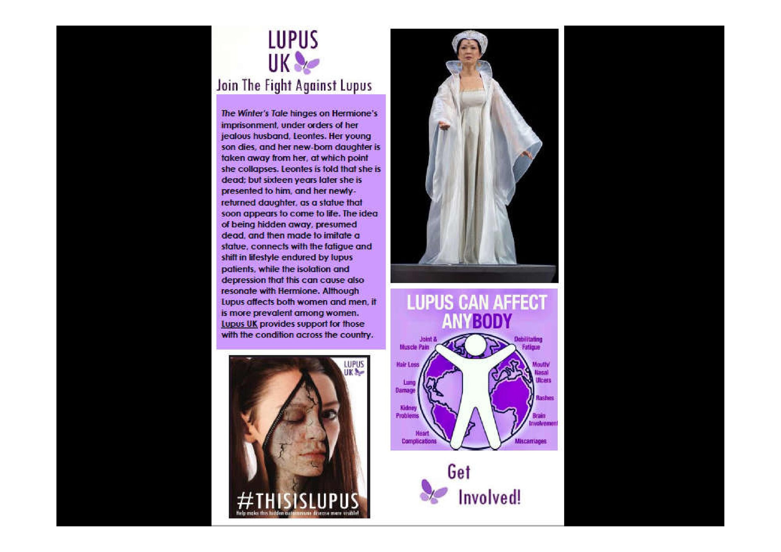  Lupus UK: Hermione in Winter's Tale 