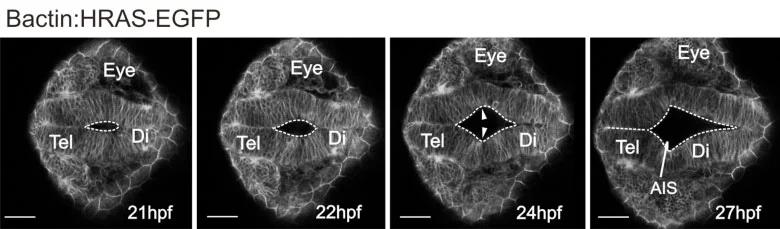 Figure 4. Formation of anterior intraencephalic sulcus (AIS). Time-lapse sequence of a transgenic β-actin:EGFP embryo. The midline lumen opens out at the telencephalic-diencephalic boundary to form the AIS. Inflation of the ventricular space leads to a lateral protrusion of the telencephalon in its caudal region (arrowheads).