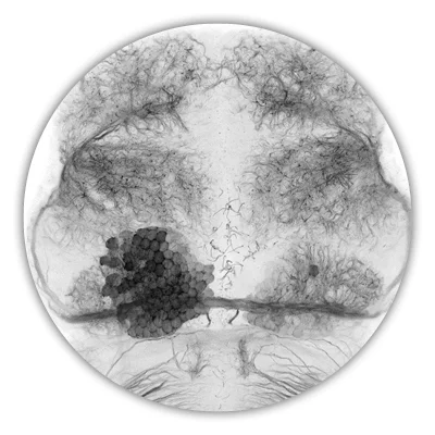 The asymmetric brain