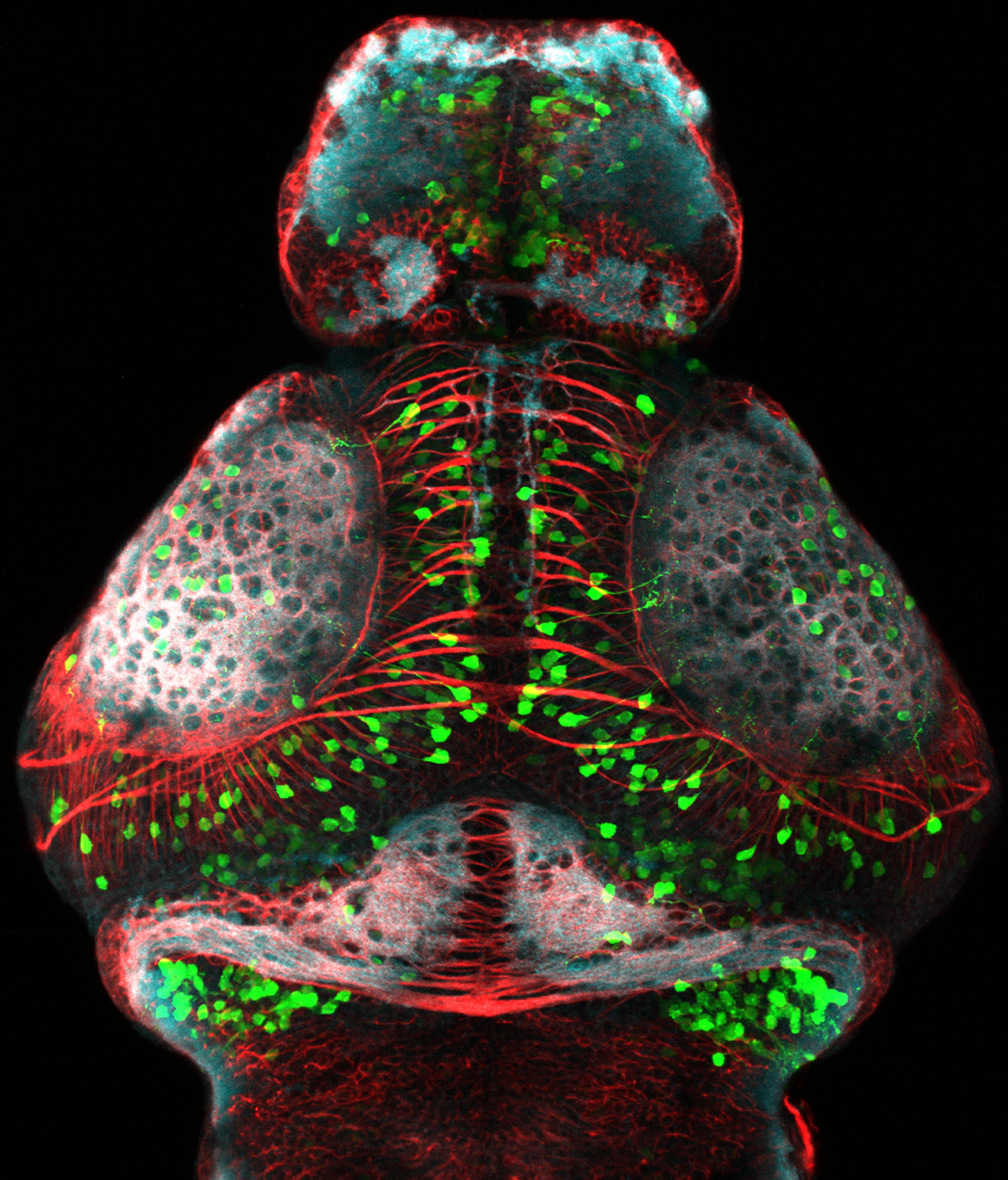 GFP positive tectal neurons with axons(red) and neuropil(white)