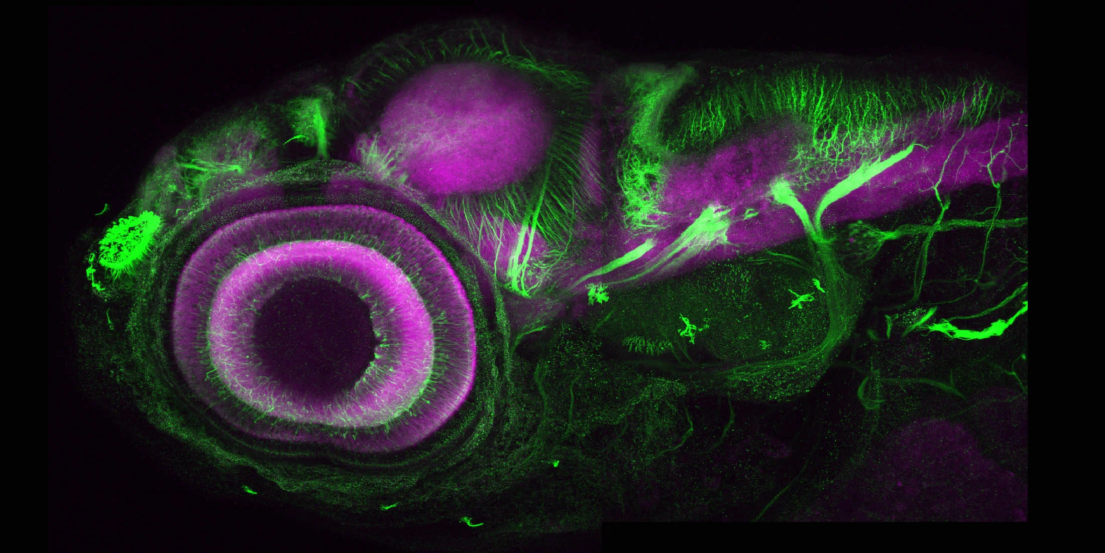 Axons and Neuropil (Lateral I)
