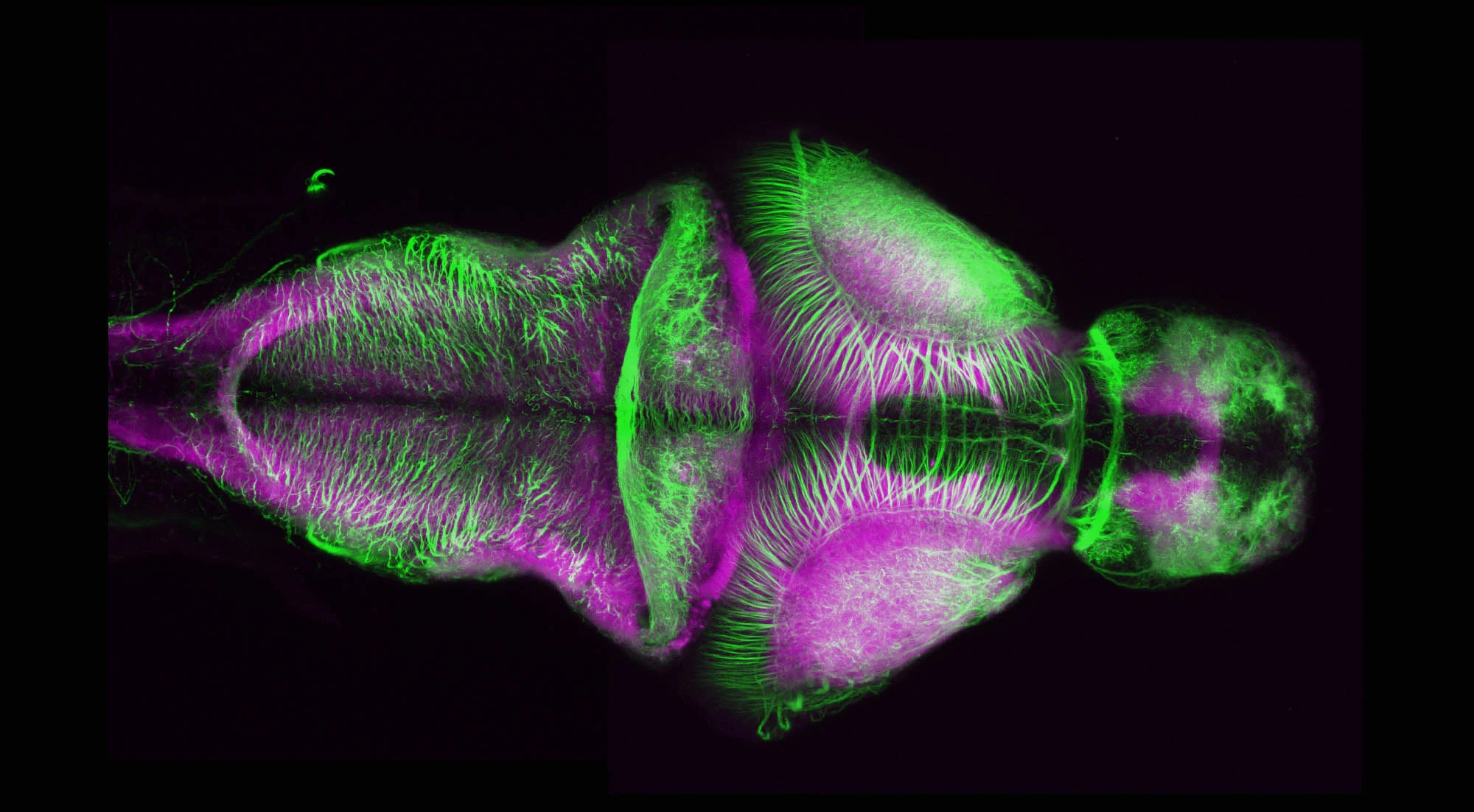 Axons and Neuropil (Dorsal II)