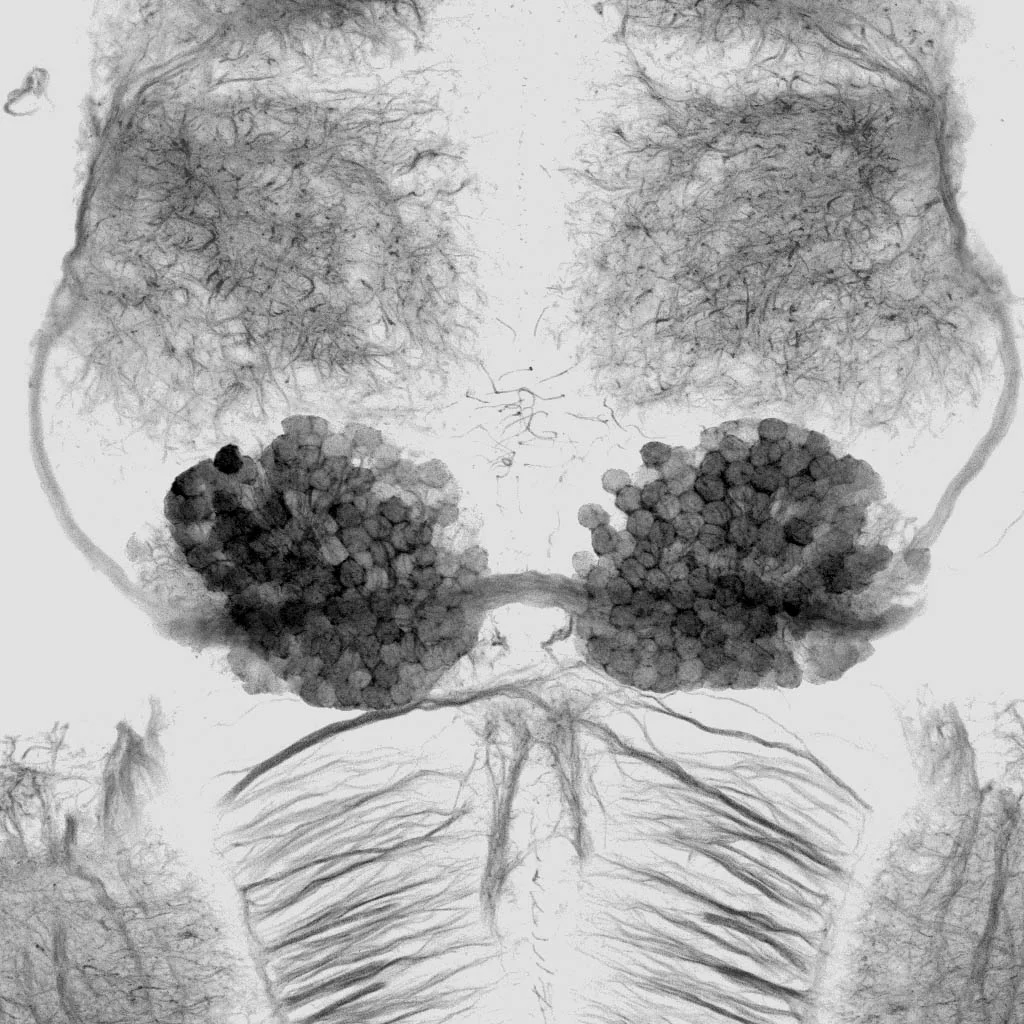 Dorsal view of the forebrain of a asymmetry mutant zebrafish