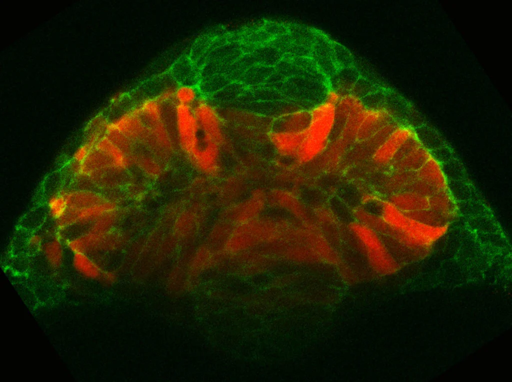 Evagination of the optic vesicles