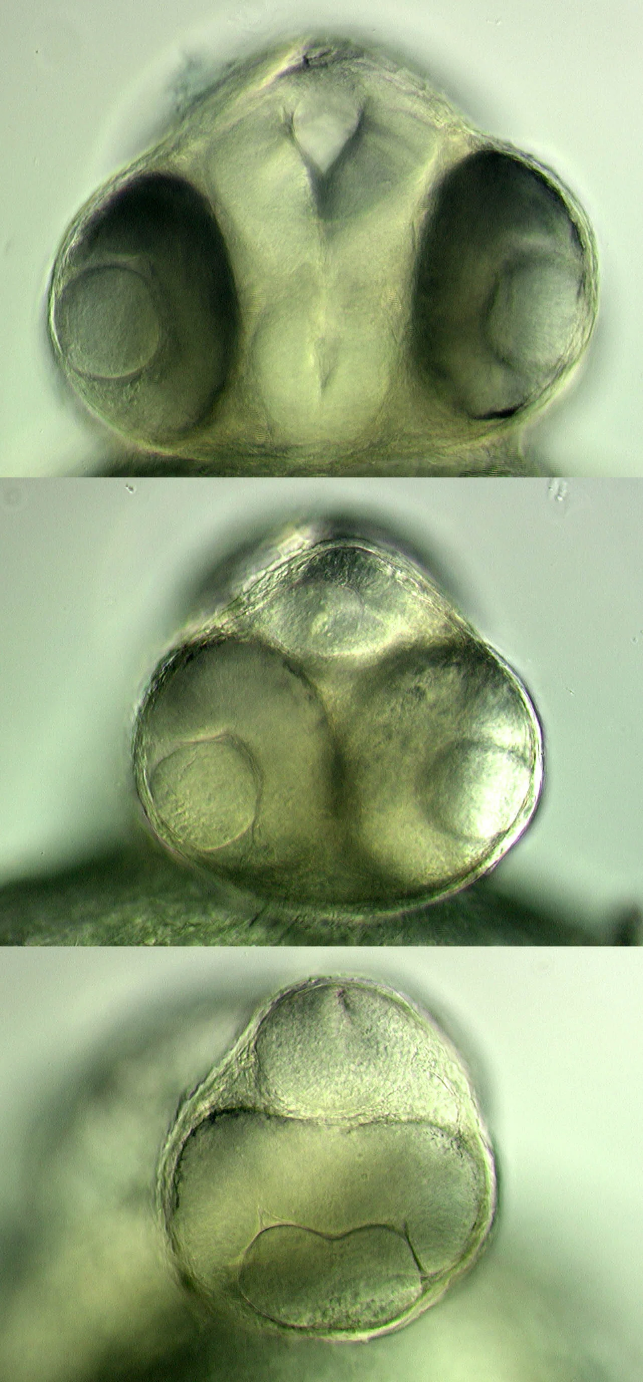 Frontal views of wildtype, Cyclops and one-eye-pinhead embryos
