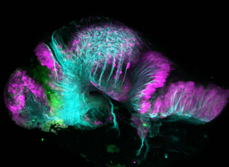 lhx5:GFP/vglut2a 48hpf lateral view