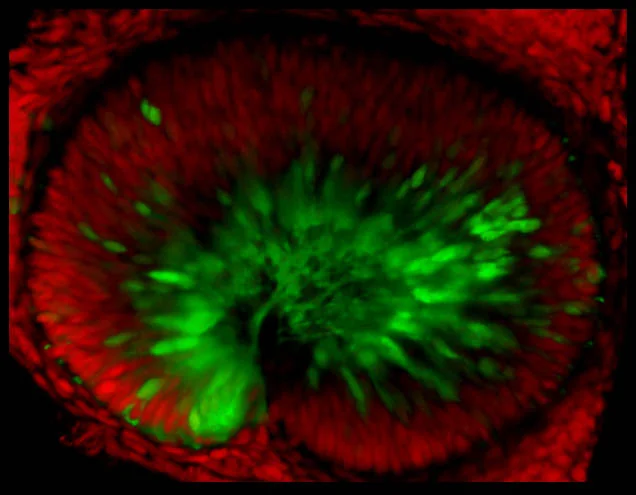 Newly born retinal ganglion cells