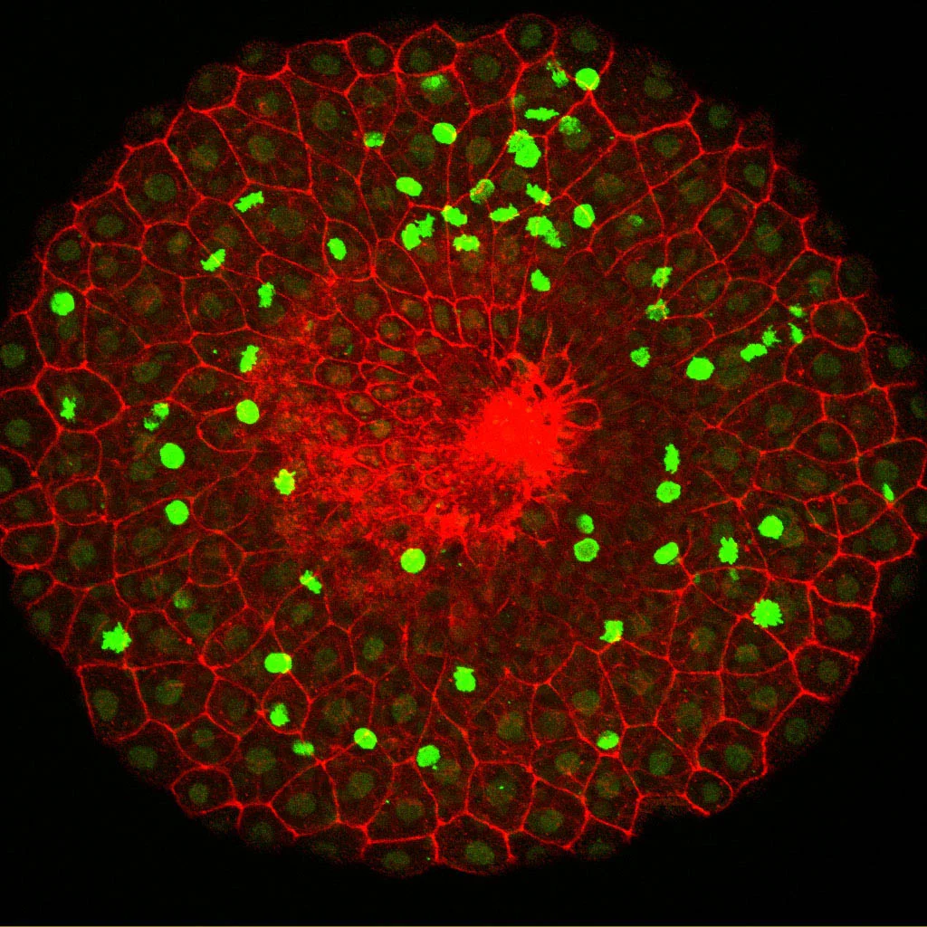 Absence of dividing cells in a wound