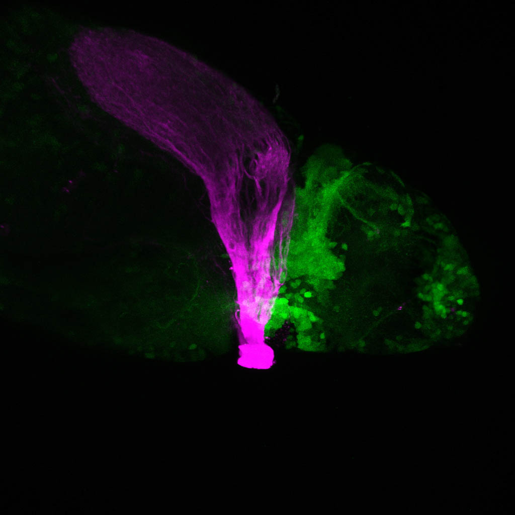 Where the optic tract meets the diencephalon