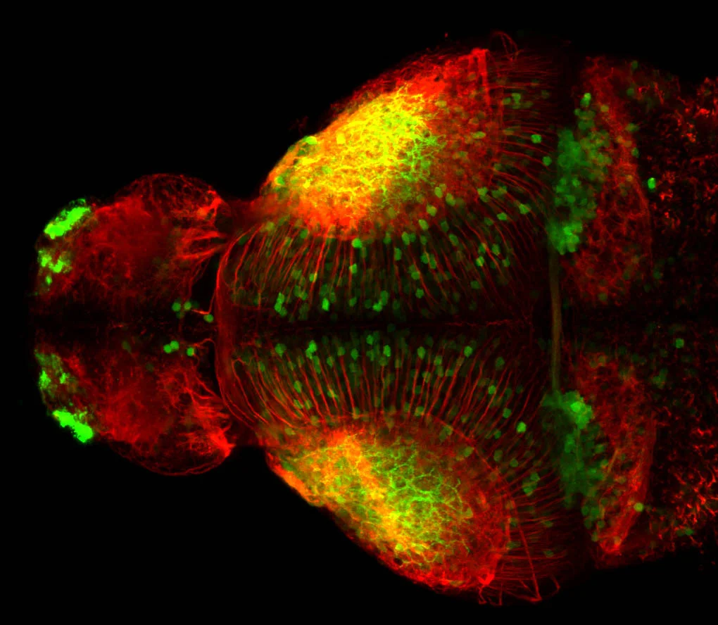 Calretinin dorsal view