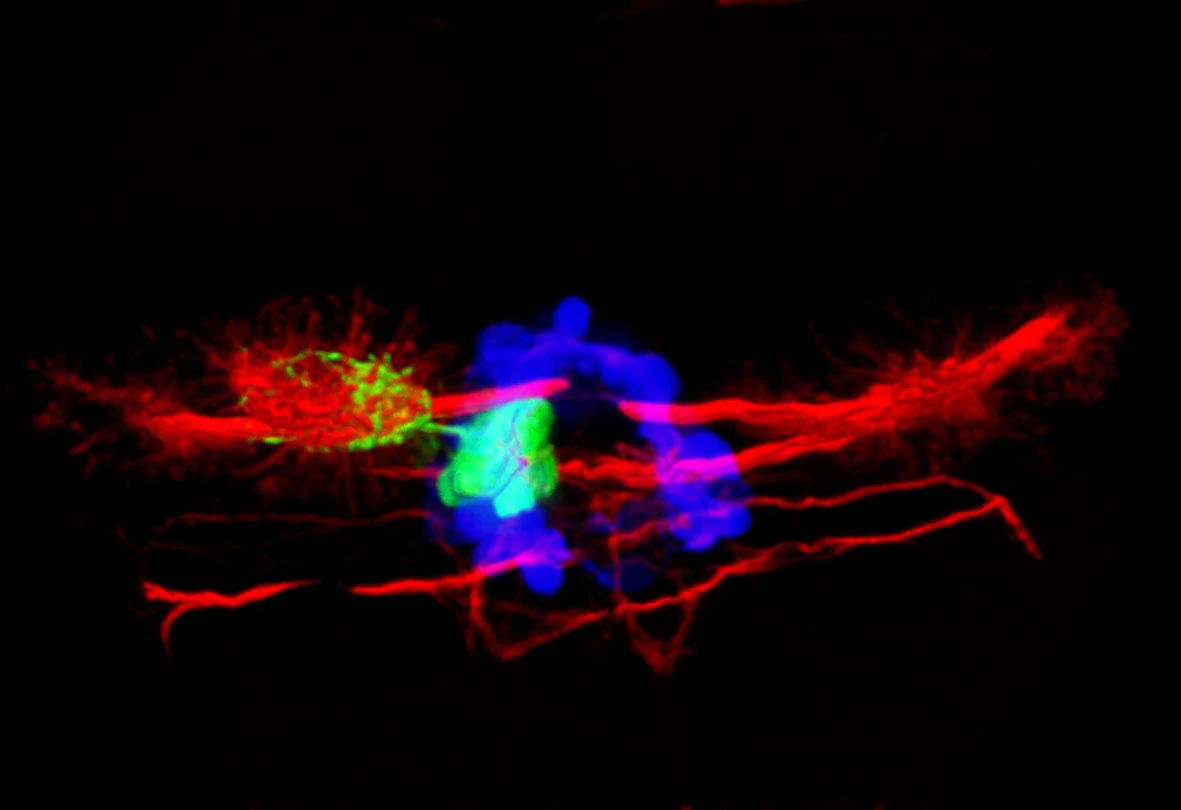 Pineal (blue), left sided parapineal (green) and habenular neuropil (red)
