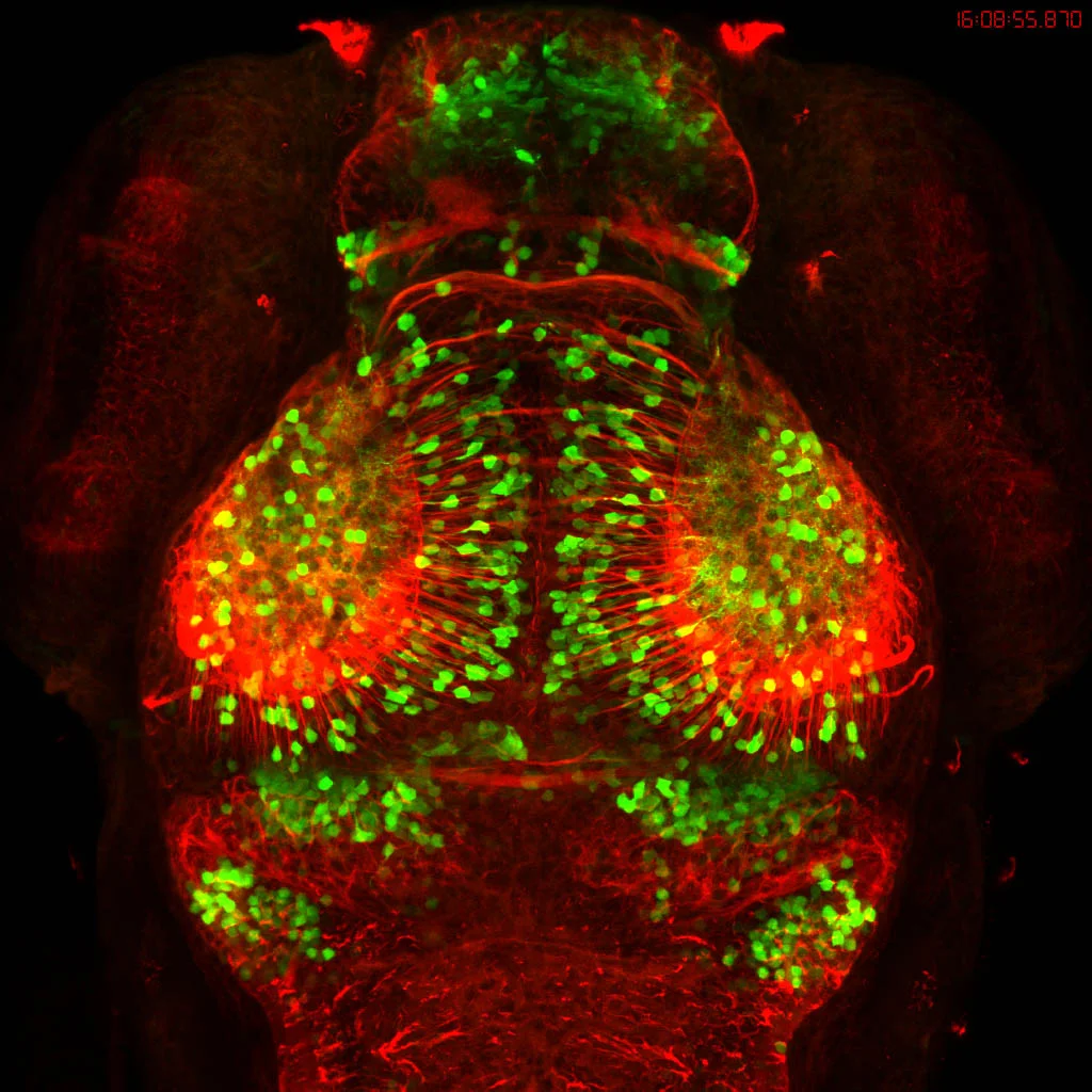 Tg(Dlx4/6:GFP)