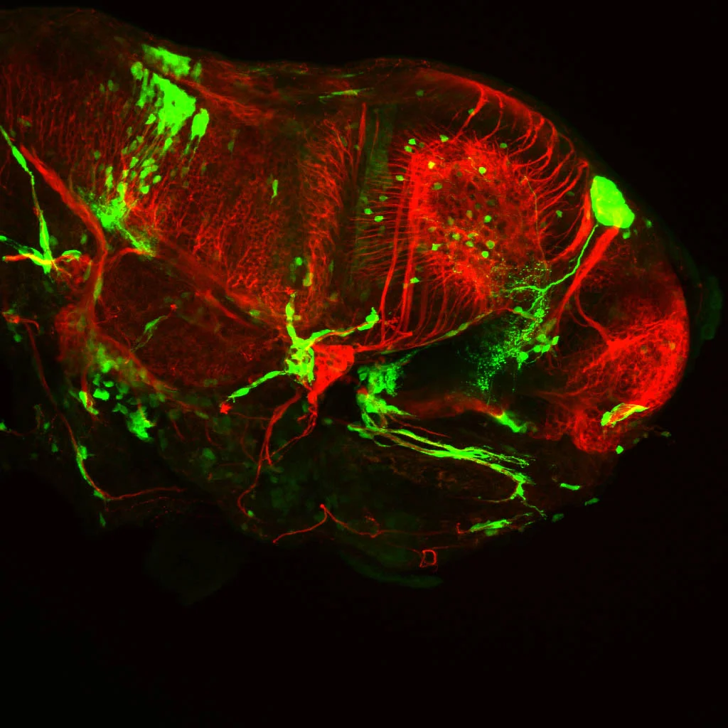 Foxd3:GFP