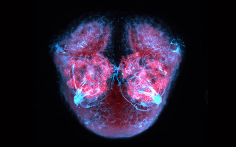 Frontal view of the forebrain of a zebrafish larva showing axons (blue) and neuropil (pink).