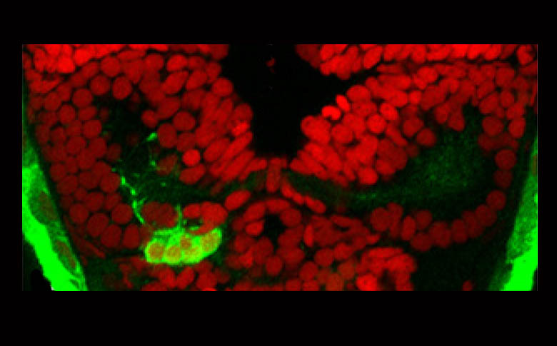 Parapineal(green) with ToPro(red).