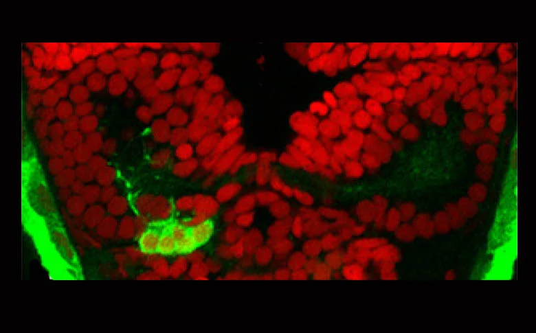 Parapineal(green) with ToPro(red).