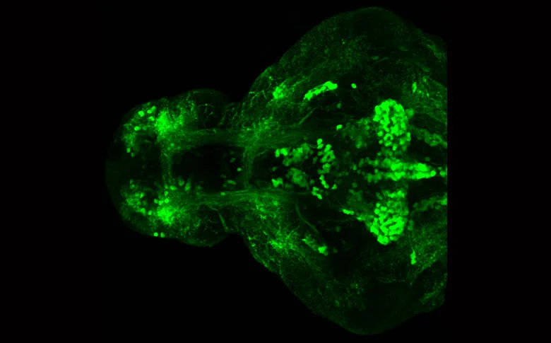Tg(vmat2:GFP)
