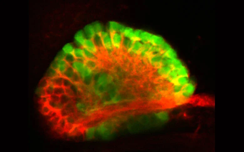 The left habenula of a Tg(ET16:GFP) embryo.