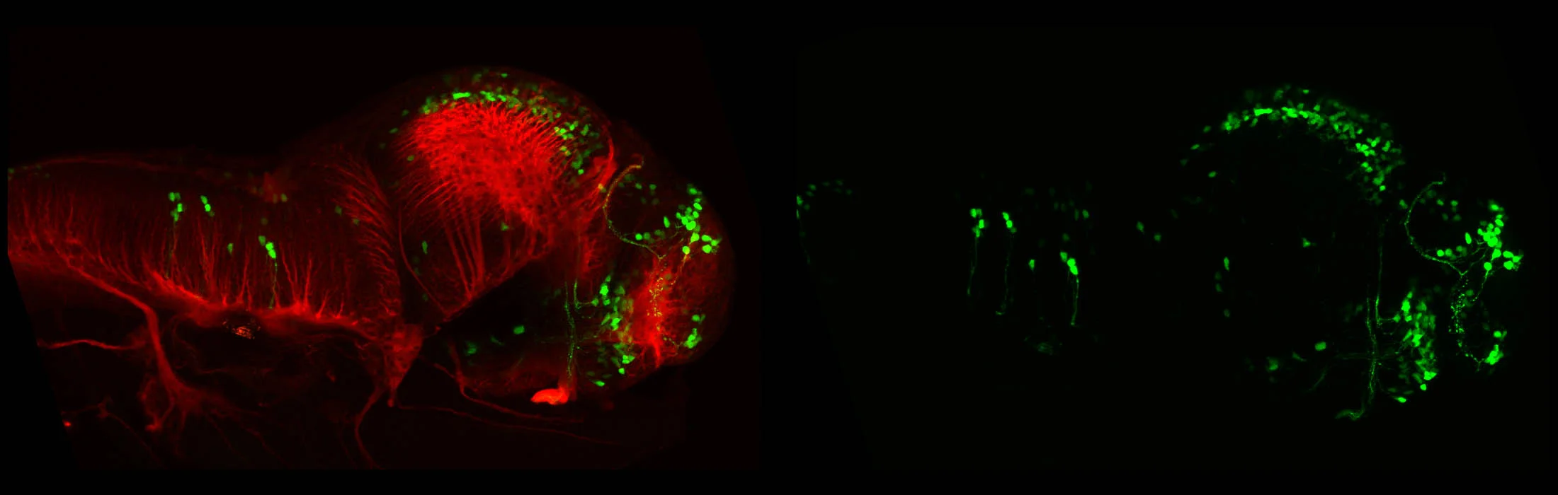 Tg(tbr:GFP)