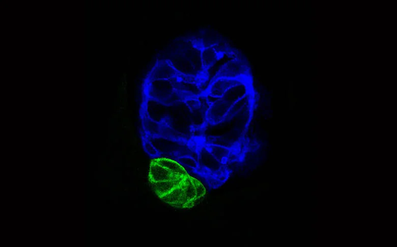 Pineal and parapineal in Tg(flh:GFP) embryo.